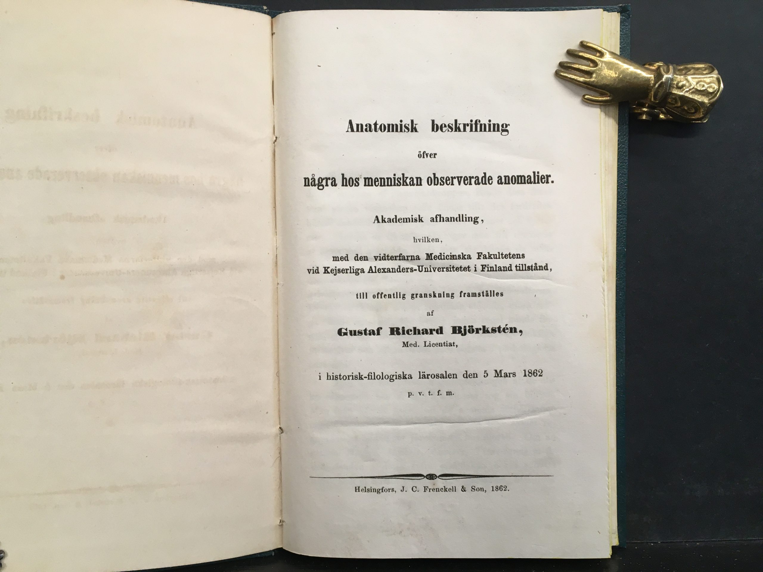 Björkstén, Gustaf Richard: Anatomisk beskrifning öfver några hos menniskan observerade anomalier (1862) - Image 2